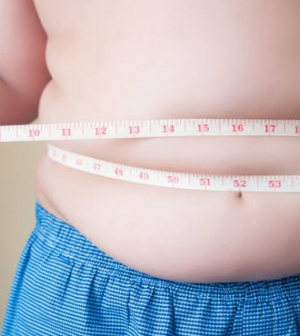 Óriási gond a gyermekkori obezitás