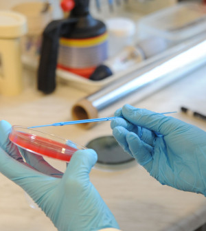 Az antibiotikum rezisztencia egyre növekvő kockázat emberekre és állatokra egyaránt